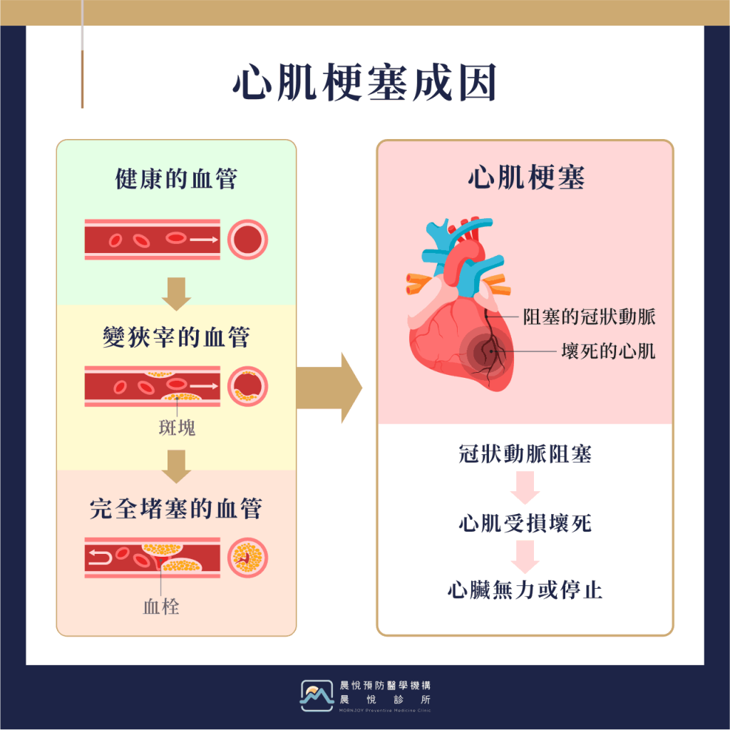 12.－心肌梗塞（晨悅）-1.png (183 KB)